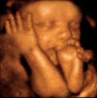 3D Image of Baby