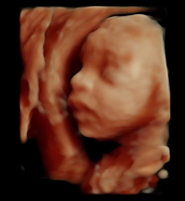 3D Baby Image