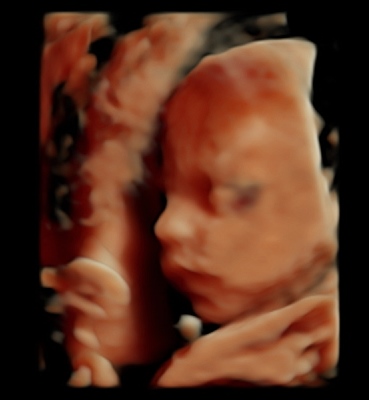 3D Baby Image Close Up